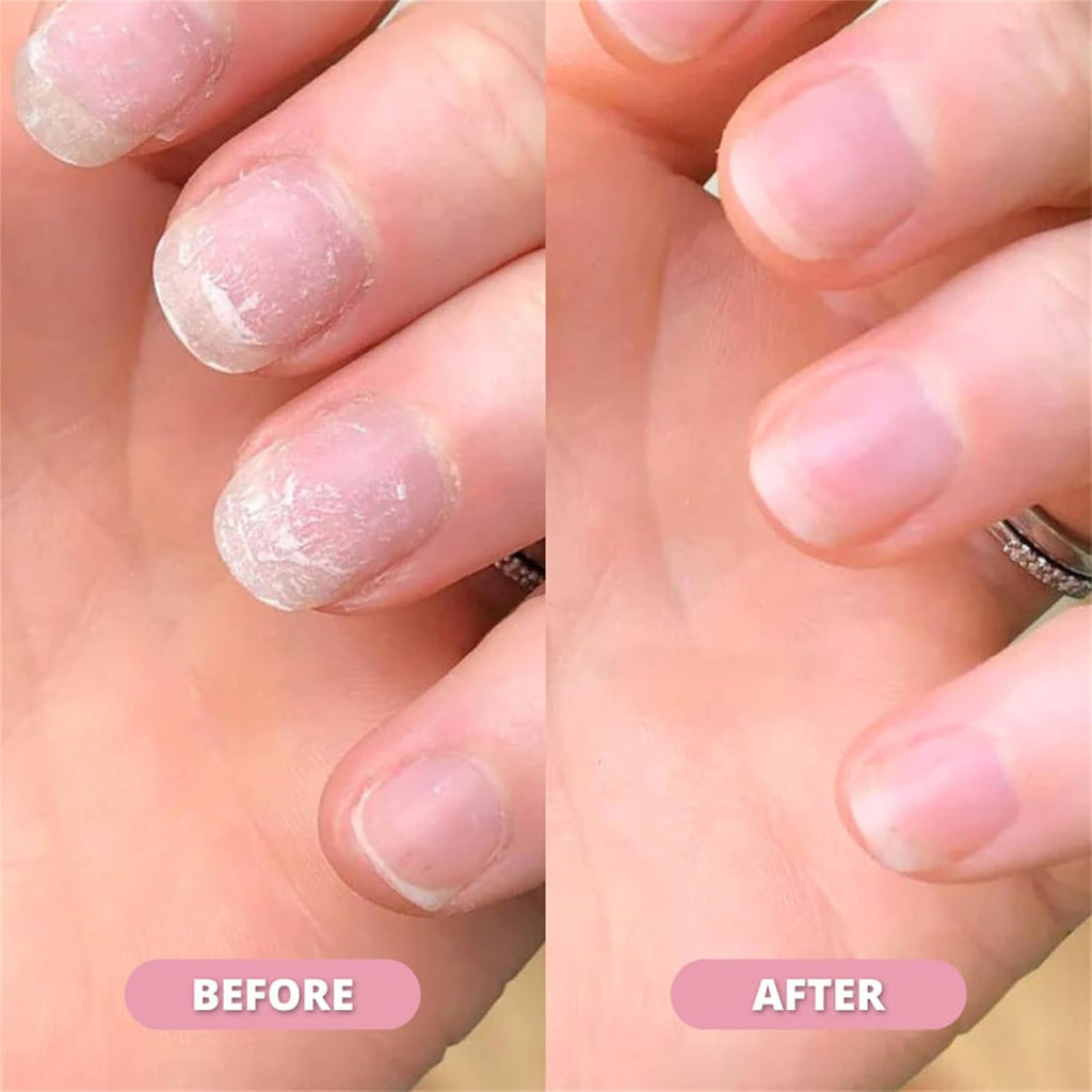 Nail Growth & Cuticle Oil Pen – Radiant Serum Nutrient Pen for Moisturizing, Strengthening & Brightening Nails